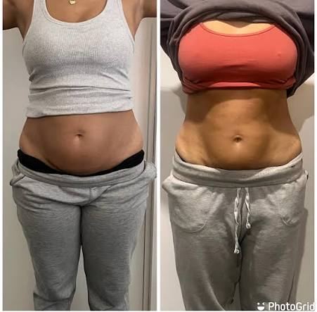 TRIMION AFRICA fat dissolving support visual