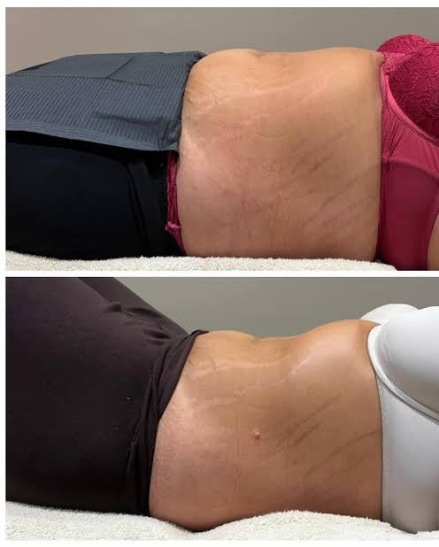 Aesthetic contouring support visual